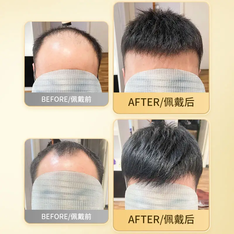 วิกผมเด็กผู้ชายแบบถักมือ ทำจากผมแท้ 100% คุณภาพดีเยี่ยม รุ่นยอดนิยม น้ำหนักเบา