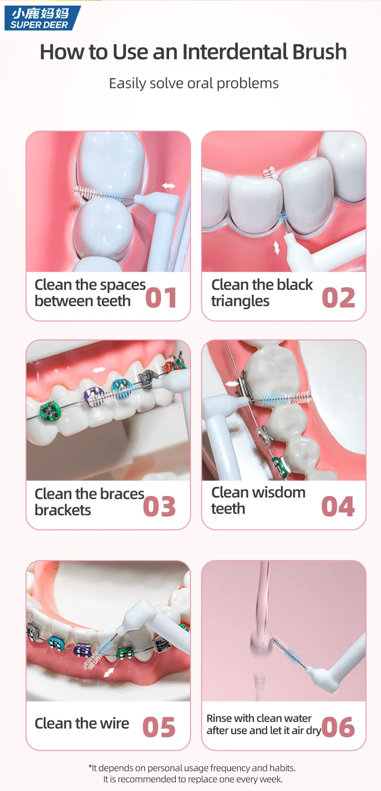 Super Deer 0,7-mm-L-förmiger Interdentalbürste mit weichen Borsten, Interdental-Zahnbürsten zur Reinigung zwischen den Zähnen, geeignet für Zahnspangen. – Detail 8