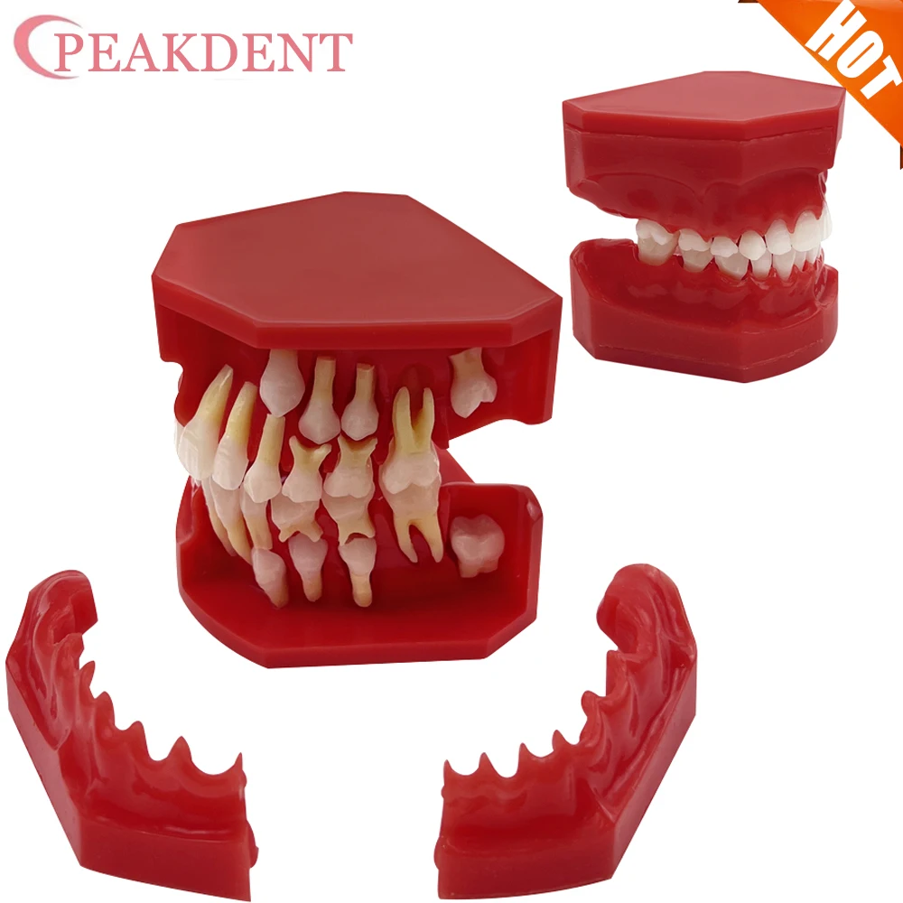 

Teeth Model Dental Teaching Model Children's Primary and Permanent Teeth Alternate Model Milk and Permanent Teeth Replacement