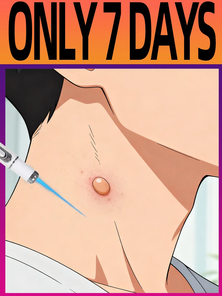 

Home-Use Blue Light Pen for Warts - Gentle Care Tool, Easy to Operate