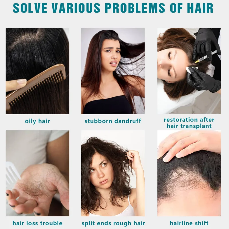 

Medical Grade LLLT Laser Cap 650nm 5-8mm for anti hair loss stress relief Postpartum Hair Loss Scalp Care Home Treatment