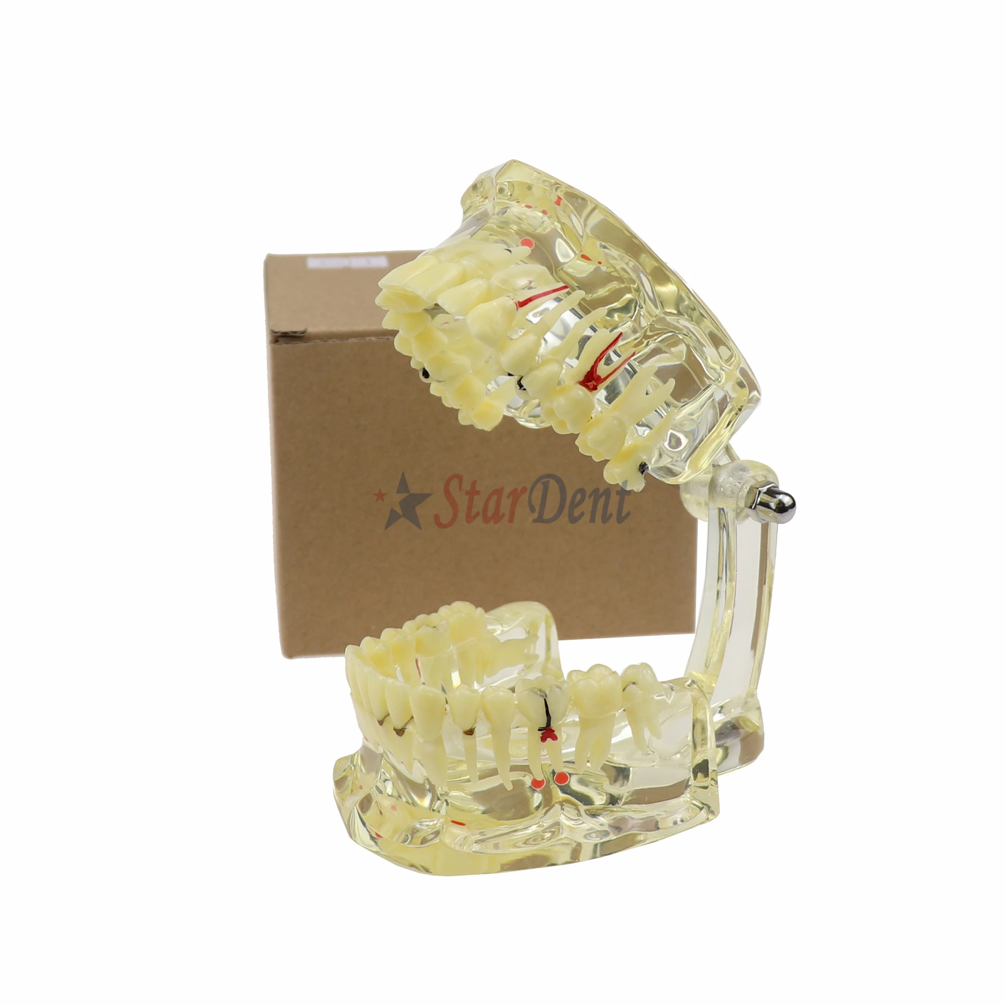 M4001 Dentals Products, Dentals Pathological Dentals Models (Missing Teeth) M4001 Adult Models Equipment