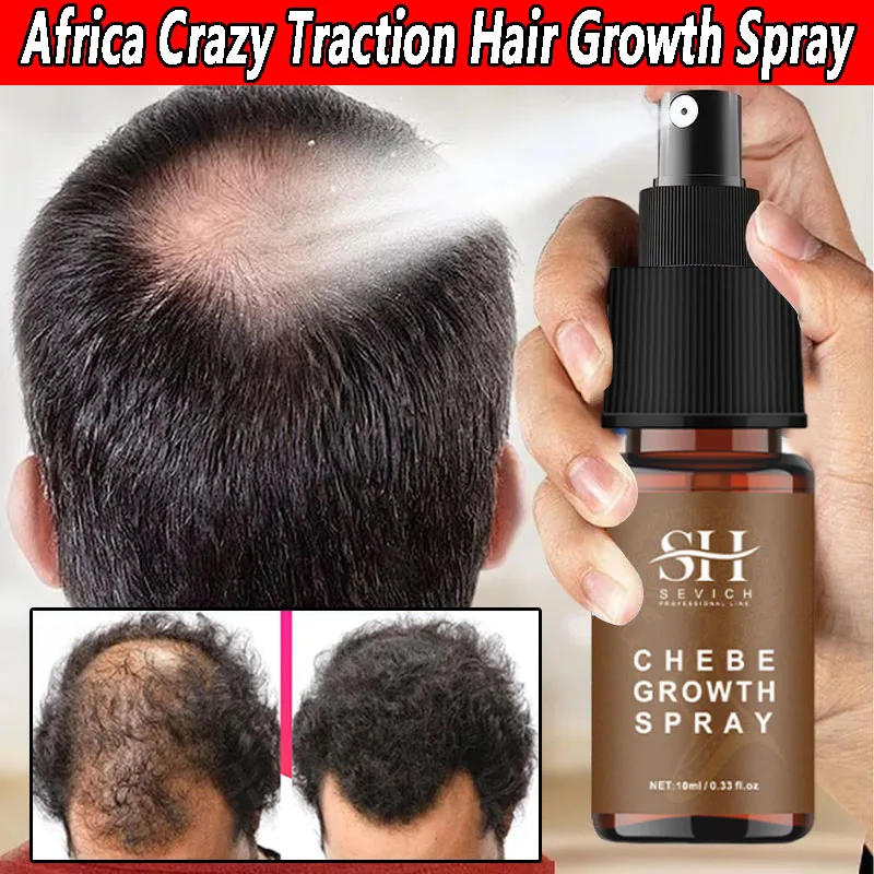 

Strong Hair Growth Spray Fast Africa Crazy Traction Treatment Hair Loss Hair Regrowth Powerful Hair Root Repair Smooth Hair Care