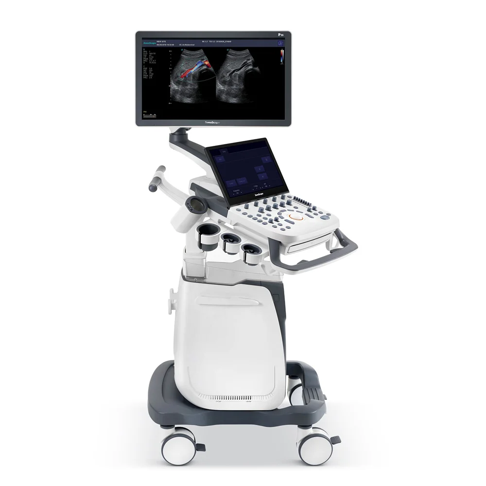 Medical Trolley Digital 3D 4D color doppler mobile medical ultrasound machine price