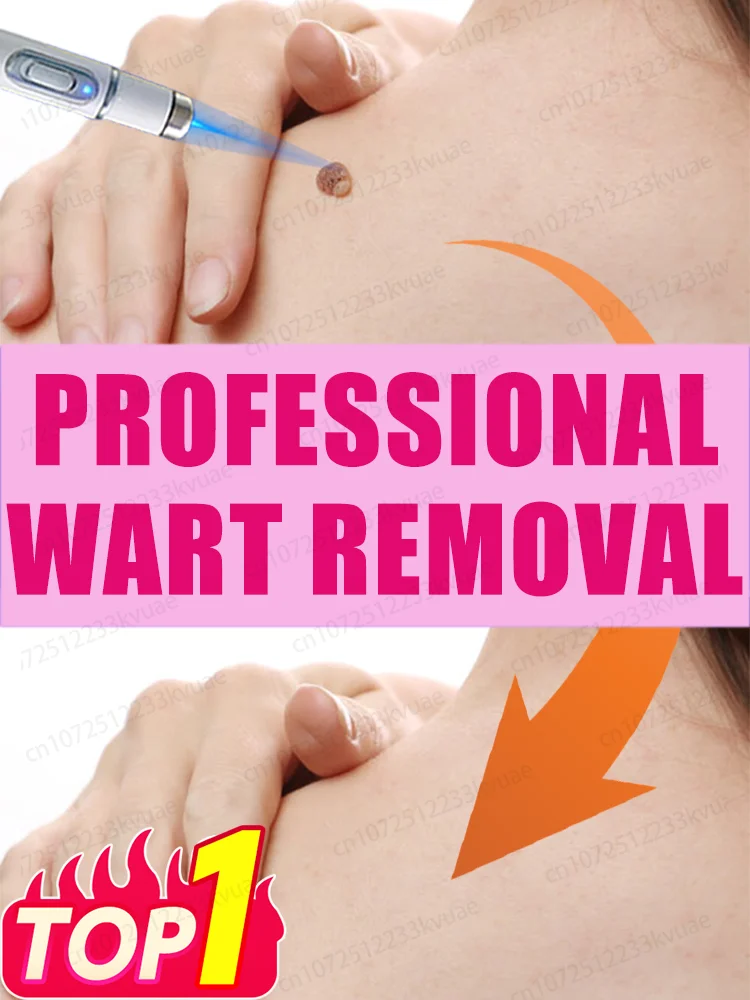 

Outil Wart Blue Light, а также изысканные уборы sur les