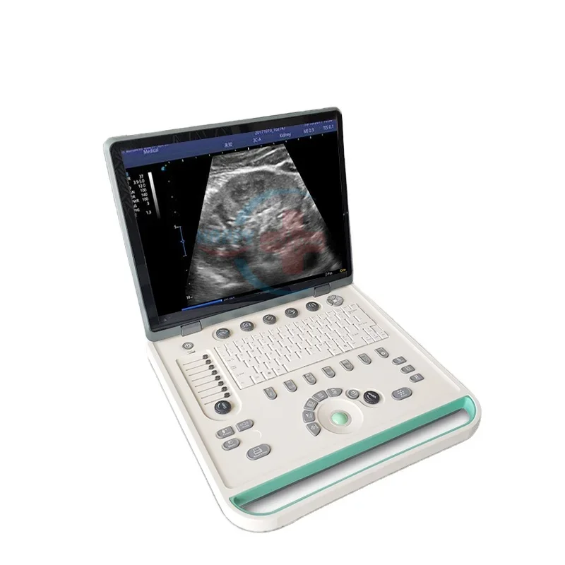 

HC-A006A 3D Ultrasound scanner machine full digital portable 15inch PC based Laptop 3D Ultrasound scanner machine