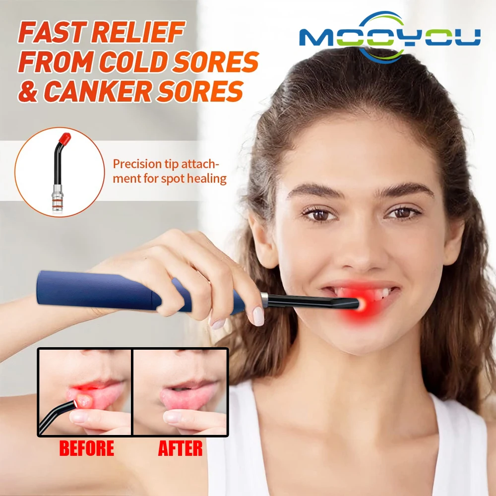 Sore Canker Lip Therapy Handheld Removable Oral Physiotherapy Wand Portable Red Light Infrared Therapy Device Health Pain Relief