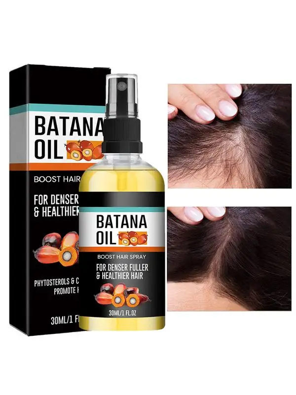 Batana-Spray Épaississant pour la Croissance des Cheveux, Huile de Batana, Hydratant, Renforce les Cheveux, Prévient la Perte, 30ml