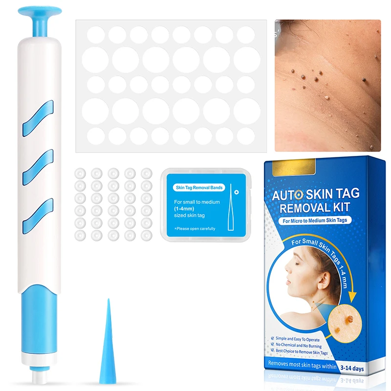 가정용 무통증 안전 피부 태그 점 사마귀 제거 장비, 매끄러운 피부를 위한 사마귀 제거기, 눈꺼풀 리프팅, 여드름 치료 펜