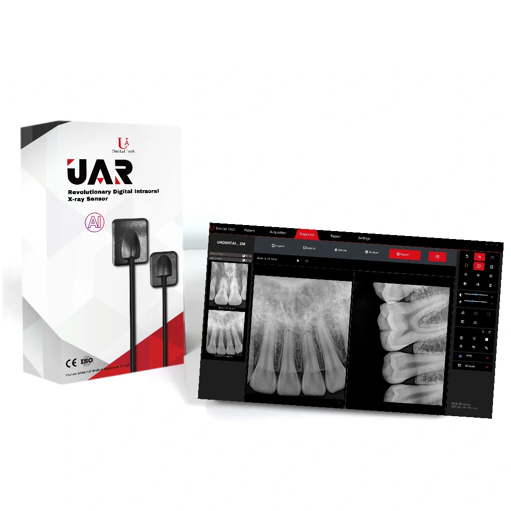 Affordable Wireless Portable Dental X-Ray - New Model Medical Apparatus