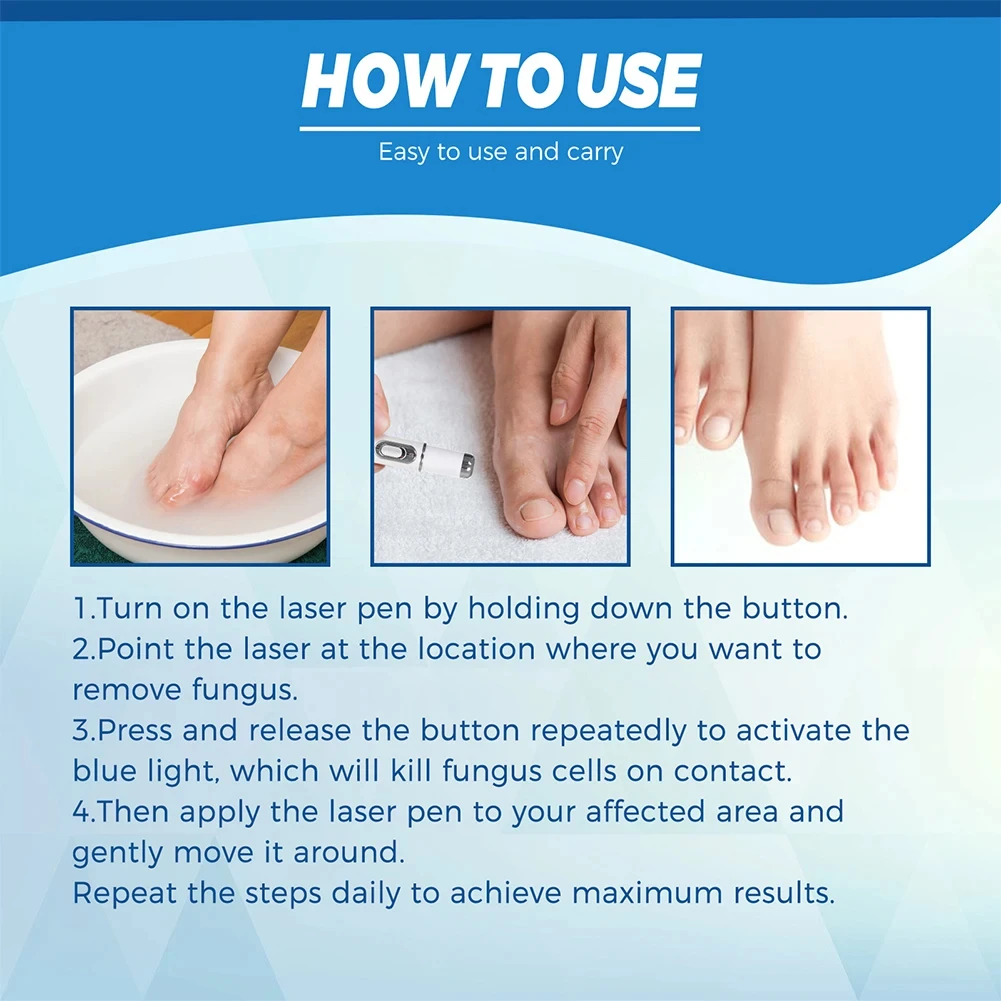 Nail Fungus Treatment Pen Anti-fungal Repair Pen Blue Light Laser Pen Paronychia Nail Onychomycosis Painless Removal Care Tool