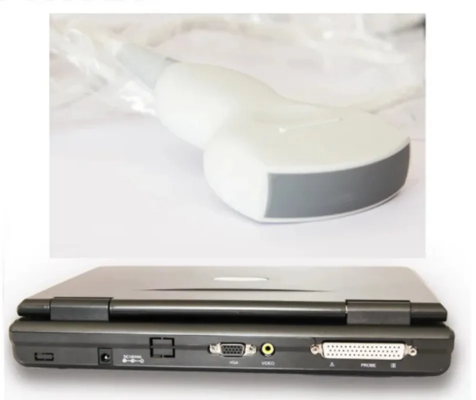 CMS600P2 Portable Digital Ultrasound Scanner CE Certified