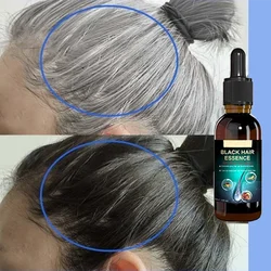 Suero de esencia antigris para el cabello, tratamiento para restaurar el color natural del cabello, saludable, blanco a negro