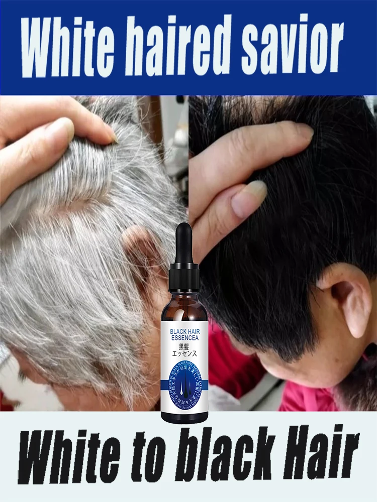 

White Hair Care - Grey hair essence Serum White Hairs Essence White To Black Natural Color Repair Nourish Product