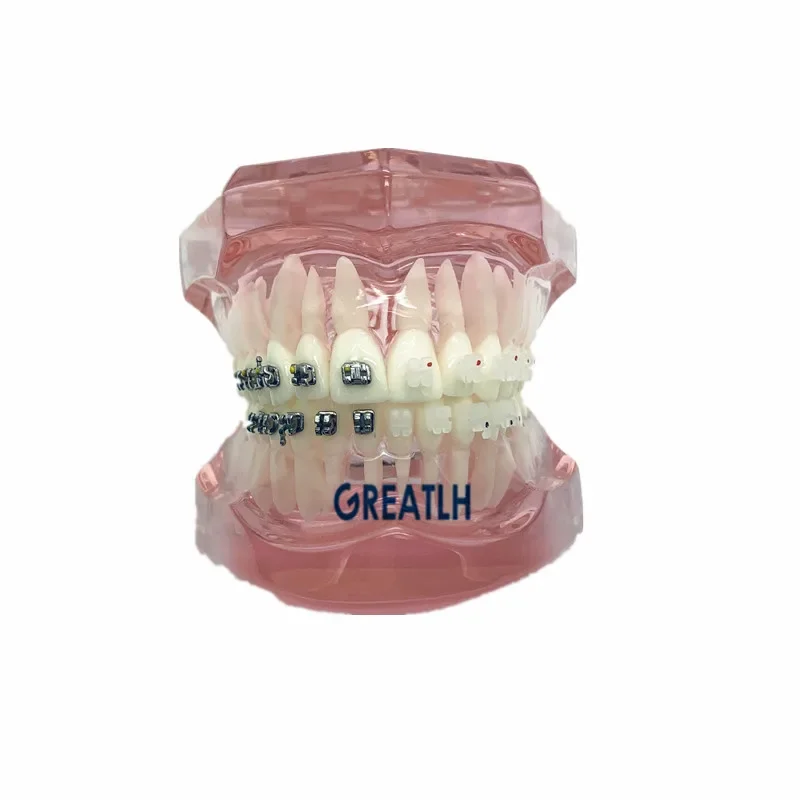 Metal and Ceramic Brackets 3003 Pink Dental School Students Teeth Study Model Dental Orthodontic Model