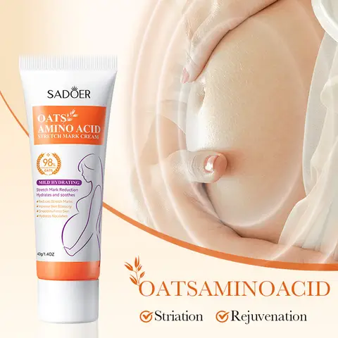 Crema Corpo Schiarente per Smagliature, Migliora le Smagliature Fini, Ammorbidisce, Idrata e Rassoda la Pelle del Corpo