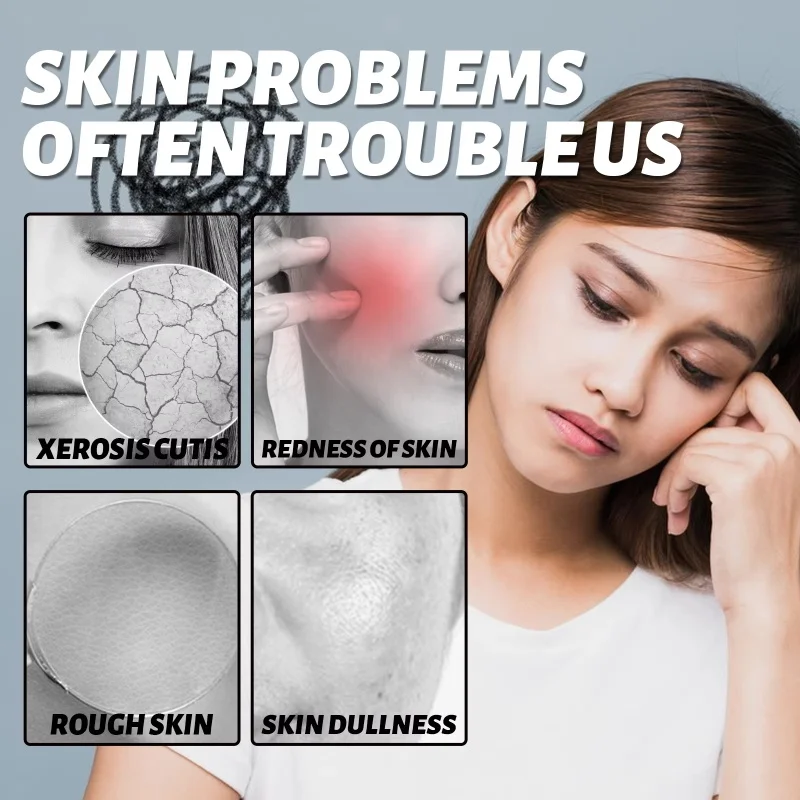Salicylic Acid Anti-Acne Serum Centella Niacinamide Oil Control Pore Refining Facial Essence Hydrating Smoothing Skin Care
