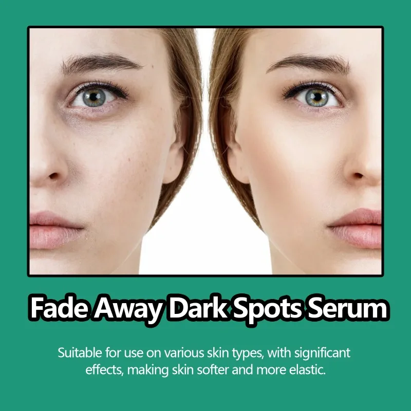 Fade Away จุดด่างดําเซรั่ม Deeply Moisturizing Brightning Vitamin C รูขุมขนหดตัว Treatment Repairing Rejuvenation Skin Care