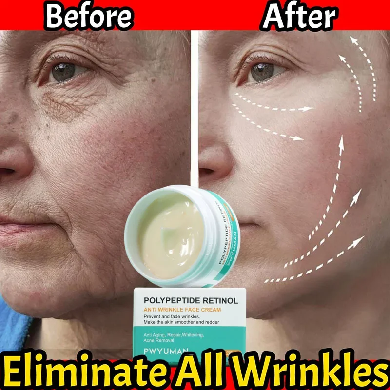 1/3/5/10/22 Retinol Anti-Wrinkle Cream Remove Face Neck Wrinkle Fine Lines Lift Firming Skin Smooth Moisturizing Whiten Facial