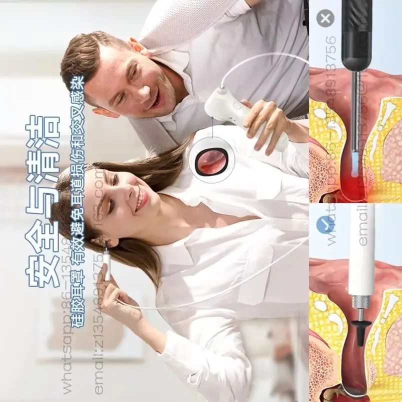 In stock, fast shipping: 3.9mm million-yuan HD ear cleaning endoscopic endoscope, visual ear spoon for home use