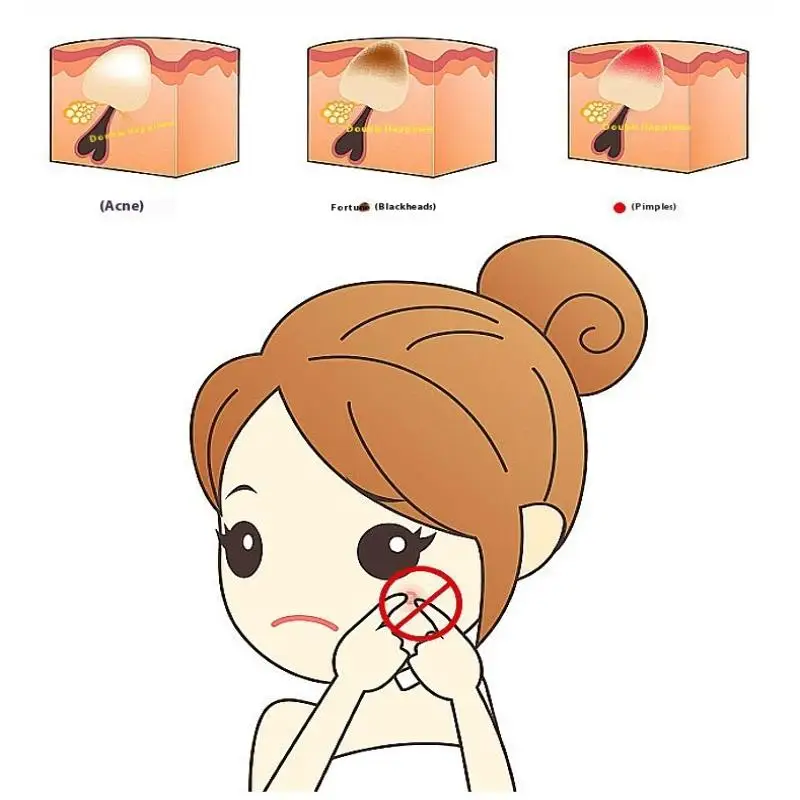 Acne Blackhead Tweezers 7-Shaped Hook Clip Facial Beauty Remove Acne Needle Tools For Skin Care