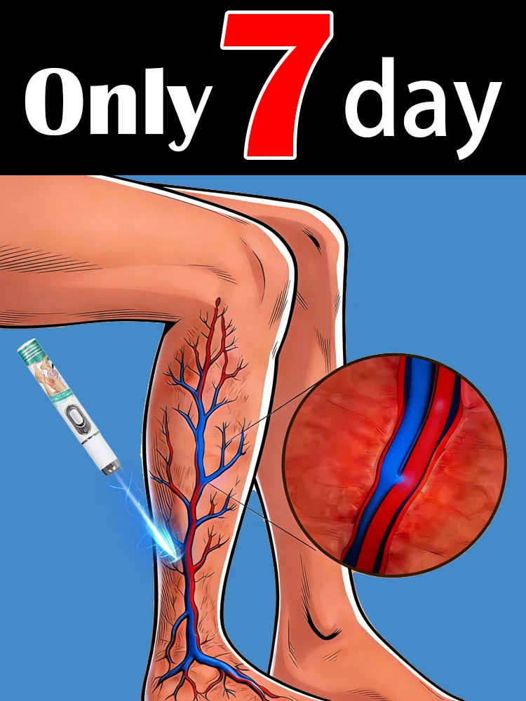 

Эффективное лечение варикозного расширения вен, облегчает состояние при расширенном васкулите и флебите ног, избавляет от операционной боли.