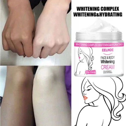 Effective Improve Body Whitening Cream Armpit Legs Knee Elbow Bleaching Cream Dull Remove Dark Spots Melanin Brighten Skin Care