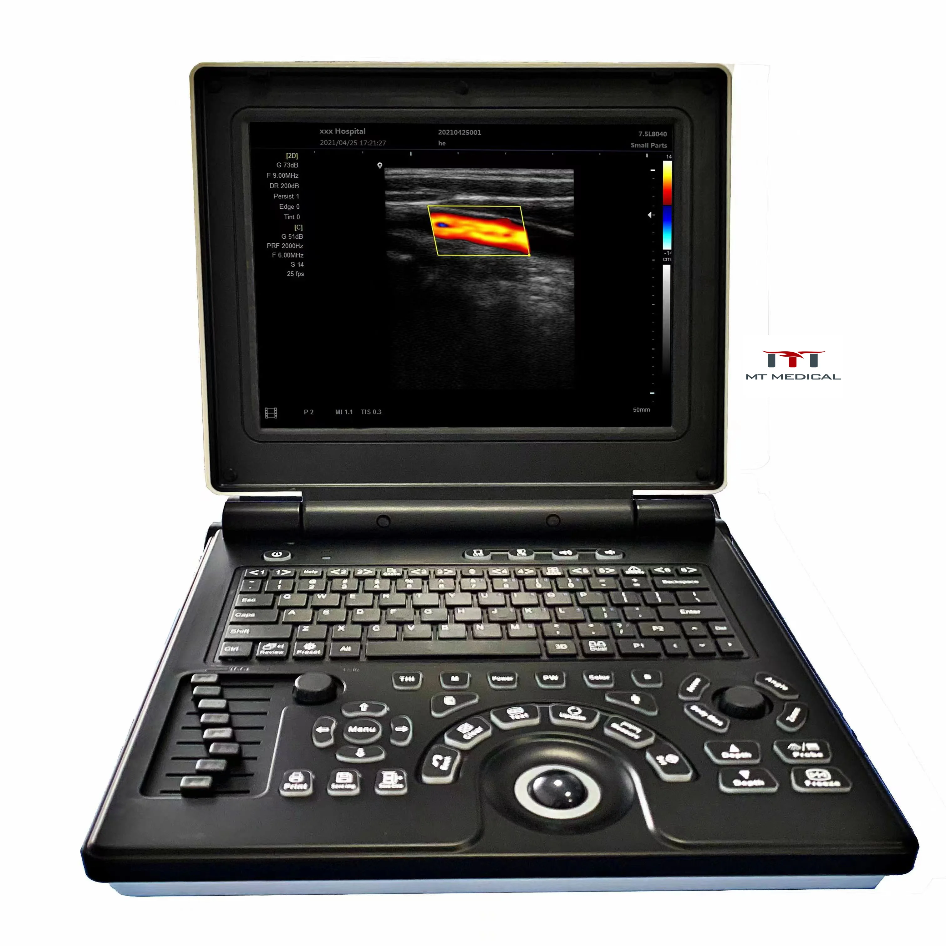 MT MEDICAL Hospital 12 Inches HD LcD Displayer  Ultrasound Machine Human Ultrasound for Human