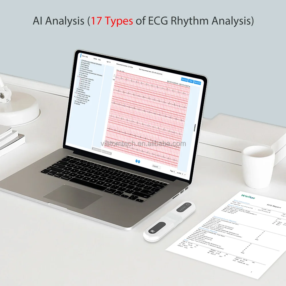 Wellue ER1-LW 72 Uur Medische Monitor Ecg Holter Monitor Ecg Event Recorder Draagbare Ecg Met AI-ECG Analyze