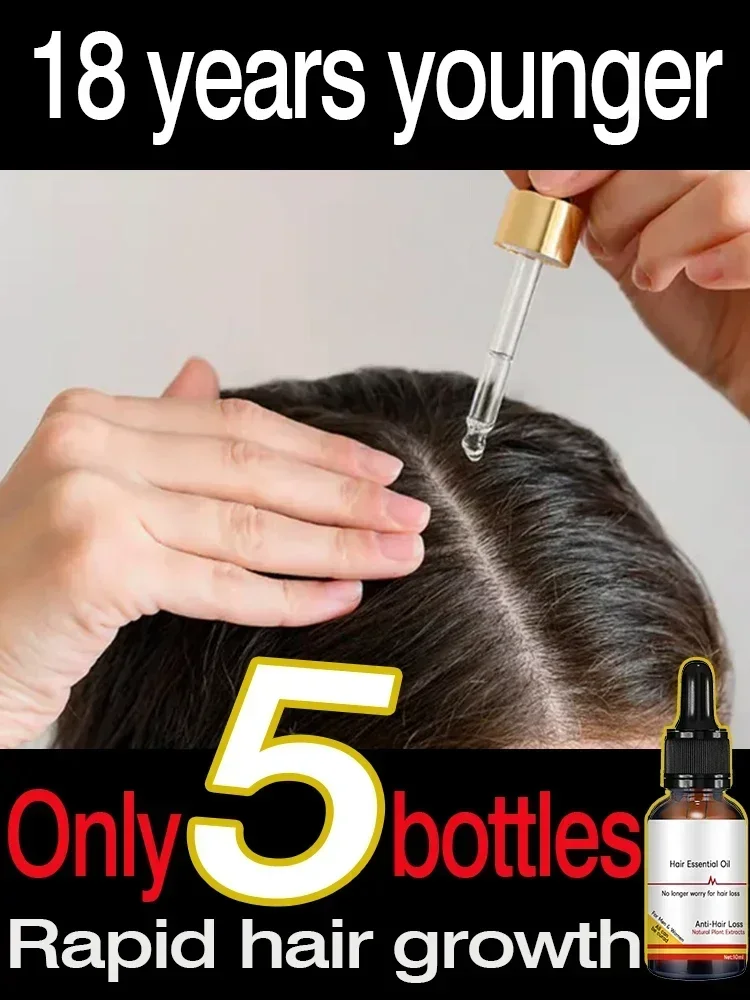 Biotin Hair Growth Products for Man Women Anti Hair Loss Ginger Serum Fast Regrowth Oil