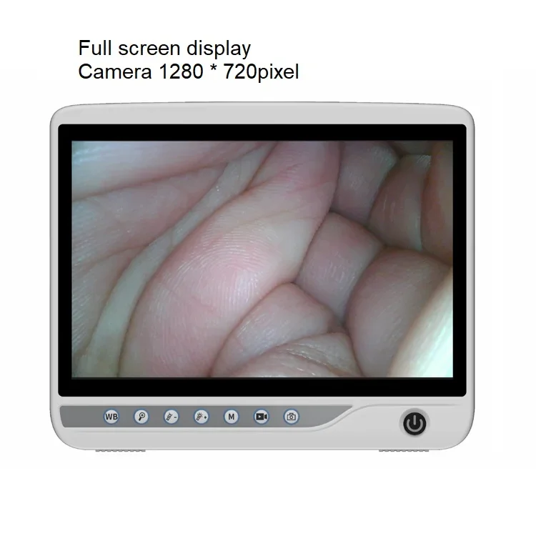 thumb