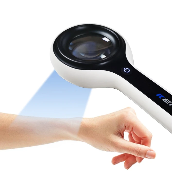 High Quality Medical Magnifier Dermatoscope Woods Lamp Skin Analyzer For Vitiligo Diagnosis