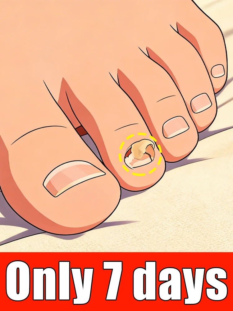 

Инструмент для ухода за ногами второго поколения, желтой формы, для решения проблем с ногтями и защиты здоровья стоп.