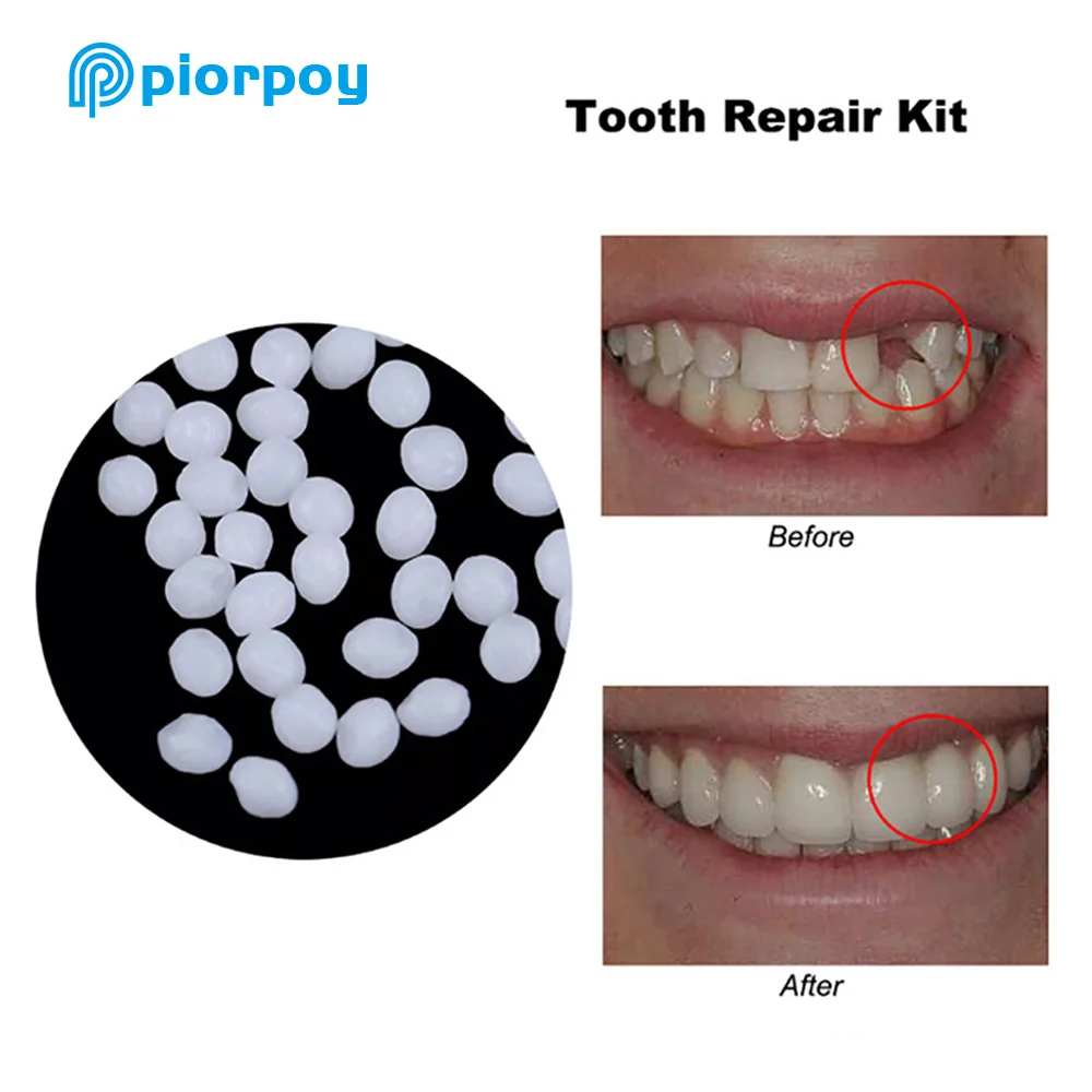 PIORPOY-Contas De Enchimento Temporário Dente, Material de Reparação Dental, Faltando Dentadura Quebrada, Dentes Falsos Cola Sólida, Produto