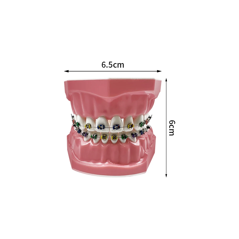 Dental Teeth Model Orthodontic Treatment Model With Fullly Metal Bracket Ortho Jaw Model Typondont    For Teaching Studying Demo