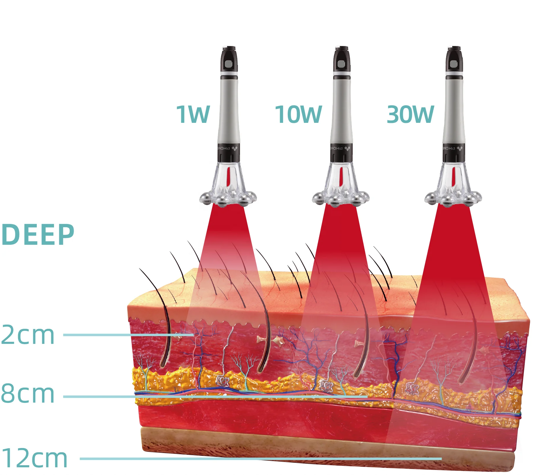 

laser class 4 therapy veterinary therapy laser cold laser pain management therapy device