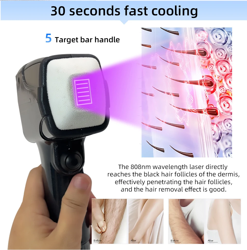 New Style Portable 808 NM wave Diode Laser Permanent Hair Remove Fast Depilation Painfree Follicle Penetration Skin Rejuvenation