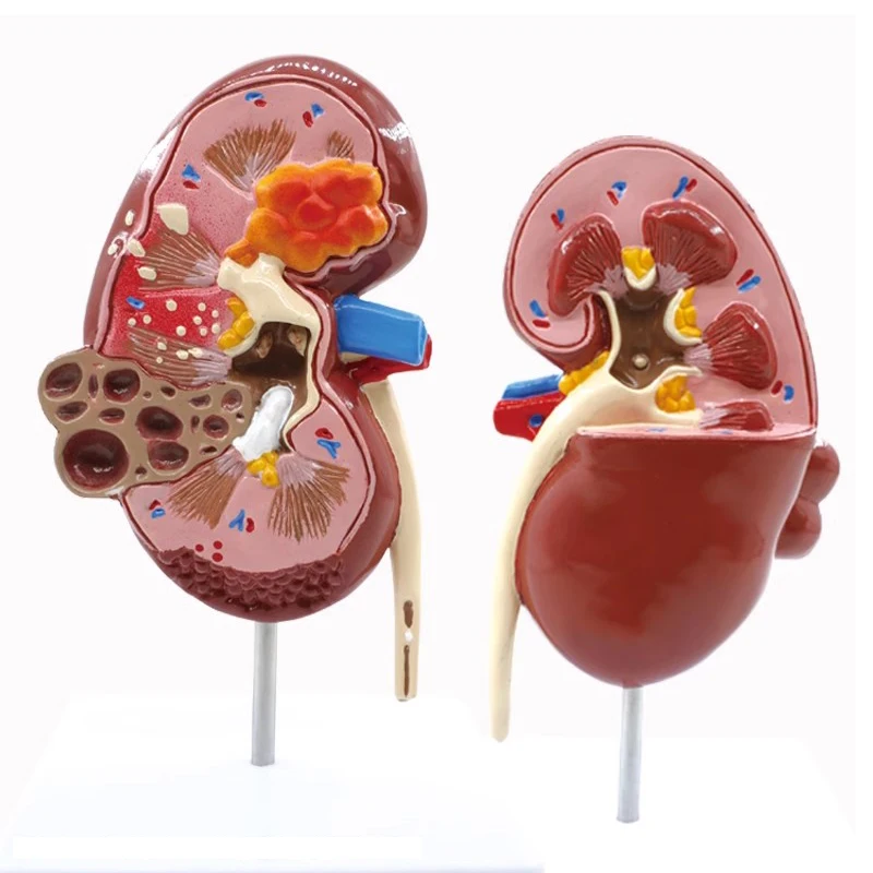 Medical teaching of renal structure of urinary system with natural large kidney model in human urology