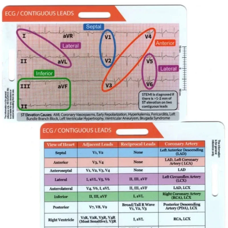 ECG/EKG Rhythm Pocket Card Pocket Card For ECG Self Measuring Ruler EGG Contiguous Leads Precision Measurement Household Tool