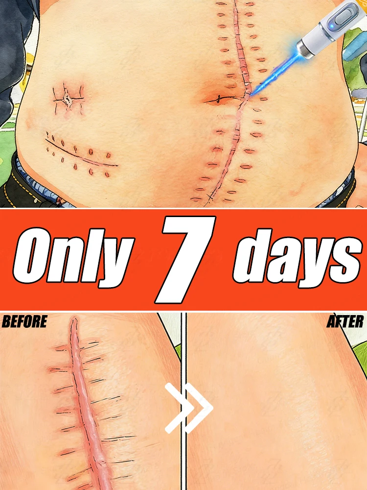 

Горячая новинка 2026 года: Удаление всех типов шрамов. Восстановите уверенность в себе.