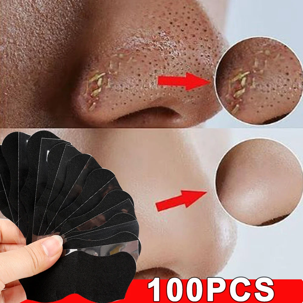 100pcs Unisex Black Nose Patch Deep Cleansing Nose Strips Acne Blackhead Removal Shrink Pore Noses Black Head Stickers Skin Care