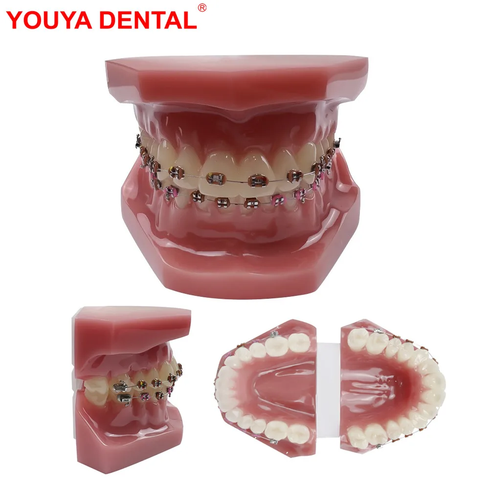 Orthodontic Dental Teaching Model With Fully Metal Bracket Normal Standard Orthodontic Teeth Model For Studying   Education Demo