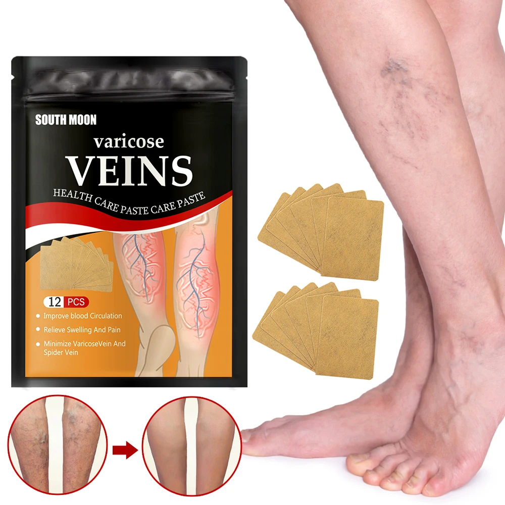 

12pcs Phlebitis Vasculitis Medical Plaster Relieve Leg Pain Leg Sore Swelling Plaster Promote Metabolism Anti Swelling Body Care