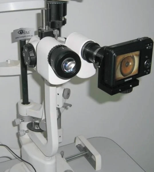 NIEUWE VISION Universele CCD-camera-adapter voor spleetlampmicroscopen en chirurgische microscopen