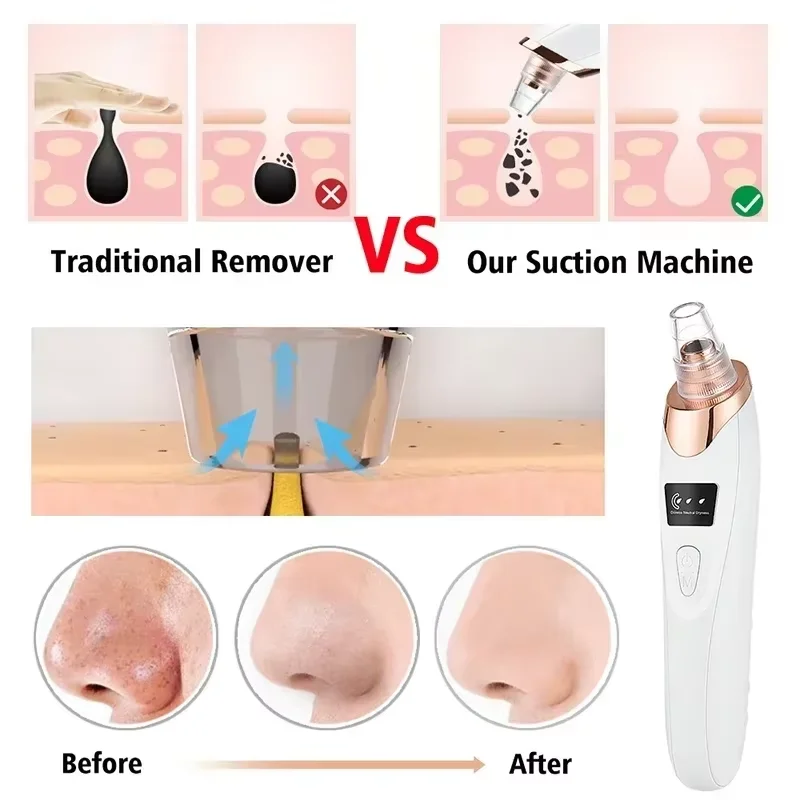Blackhead Remover Vacuum Suction USB Rechargeable Facial Pore Cleaner Spot Acne Pimple Black Head Extractor Skin Care Tool Kit