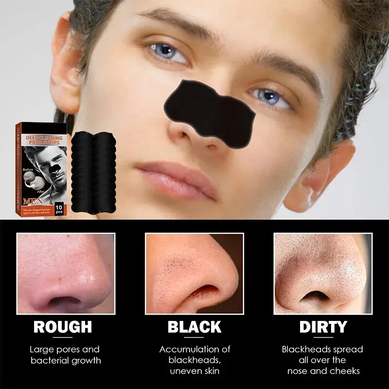 Men'S Blackheads Tighten Pores, Pimples, Acne, Blackheads Clean, Shrink And Tear Nasal Strips Easily Remove Blackheads