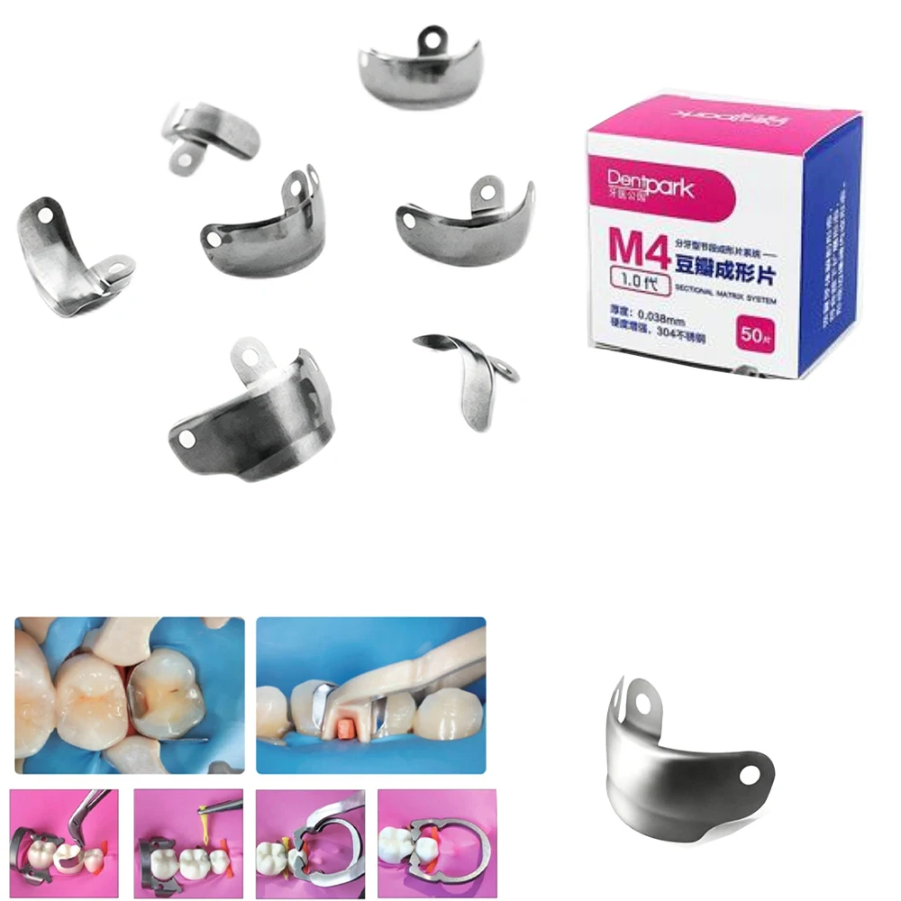 Dental 3D Sectional Matrix Band 1.0 V‑Shaped 0.038mm Thick Matrix Strip for Anterior Posterior Molar Teeth Composite Restoration