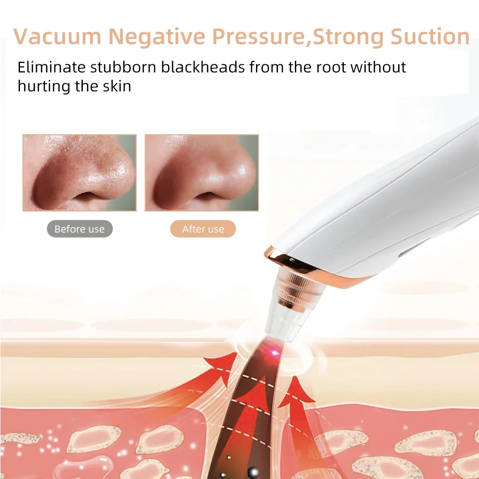 Electric Cleaner Face Blackhead Remover Multifunctional Cleaning Instrument Black Head Extractor Face Skin Care Tools 3 Gears