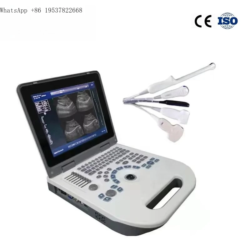 Best Human Veterinary Medical Portable  3d 4d  Machine Price