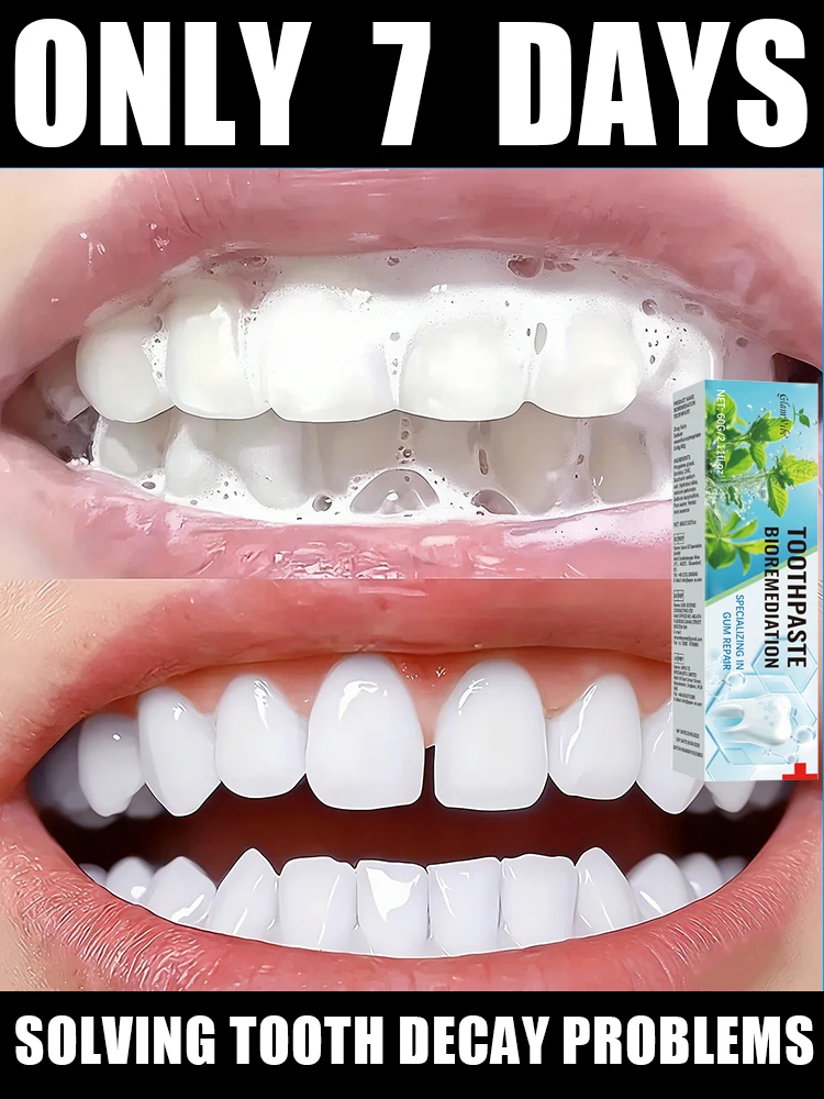 Réminéralisation, menthe fraîche, réparation de l'émail